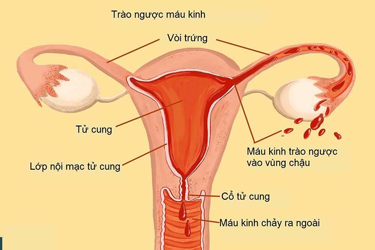 Niêm mạc tử cung của phụ nữ