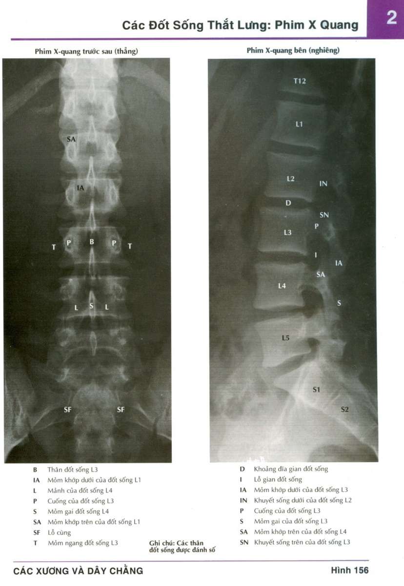 Phim X quang phần cột sống thắt lưng