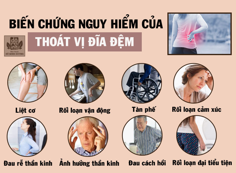 Nên mổ thoát vị khi có nguy cơ bị biến chứng tàn phế, rối loạn đại tiểu tiện...