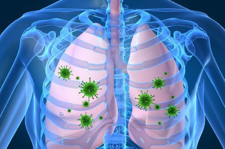 Vi khuẩn xâm nhập và tấn công gây viêm phổi hít