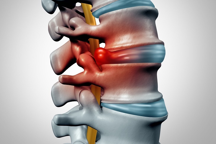 viêm khớp có nguy hiểm không là thắc mắc của nhiều bệnh nhân