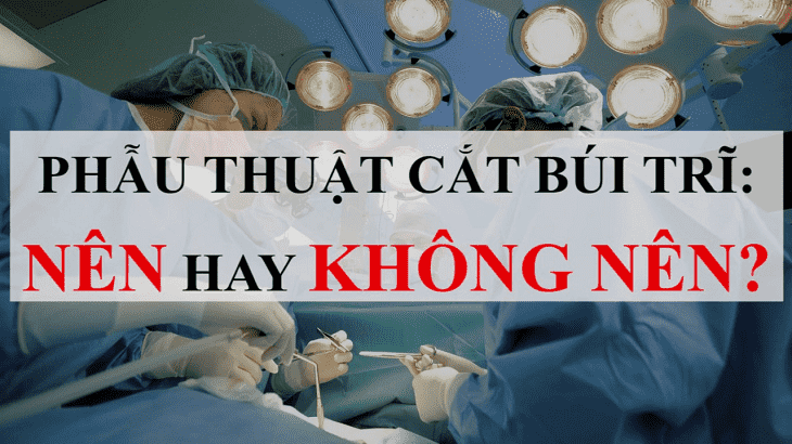 Cắt trĩ bằng phương pháp hiện đại: Nên hay không nên?