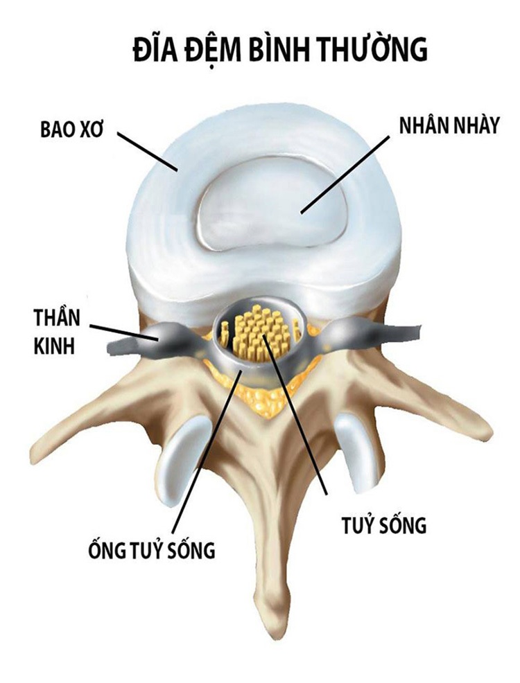 Đĩa đệm là mô sụn chứa 85% là nước, mô sợi có độ xốp và đàn hồi cao