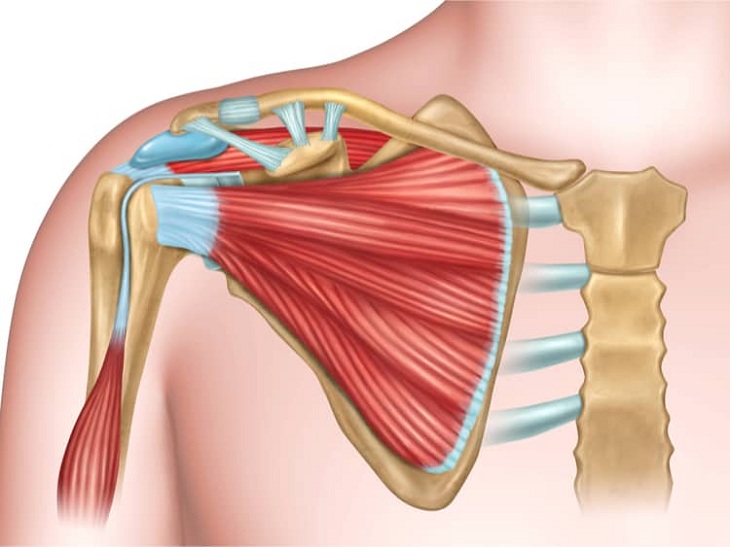 Dây chằng bị tổn thương khiến khớp cùng đòn bị lệch khỏi vị trí ban đầu