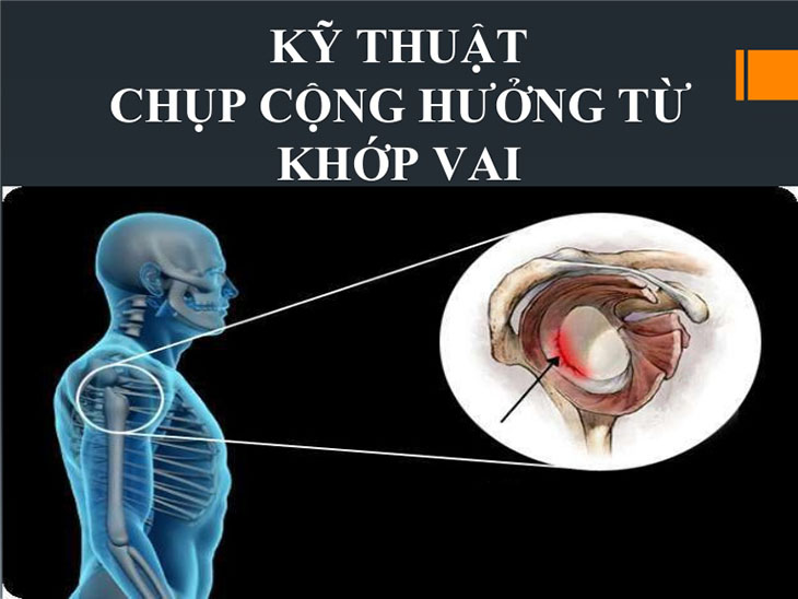 Máy từ trường được sử dụng trong chụp cộng hưởng từ khớp vai