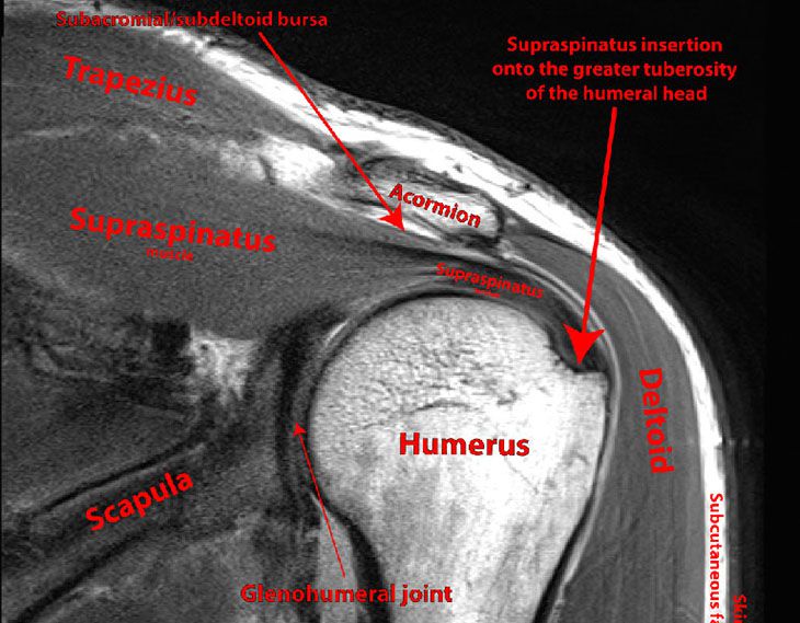 MRI vai có ý nghĩa quan trọng trong chẩn đoán lâm sàng