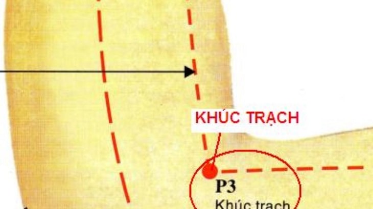 Huyệt khúc trạch có liên quan đến phần gân cơ khuỷu tay