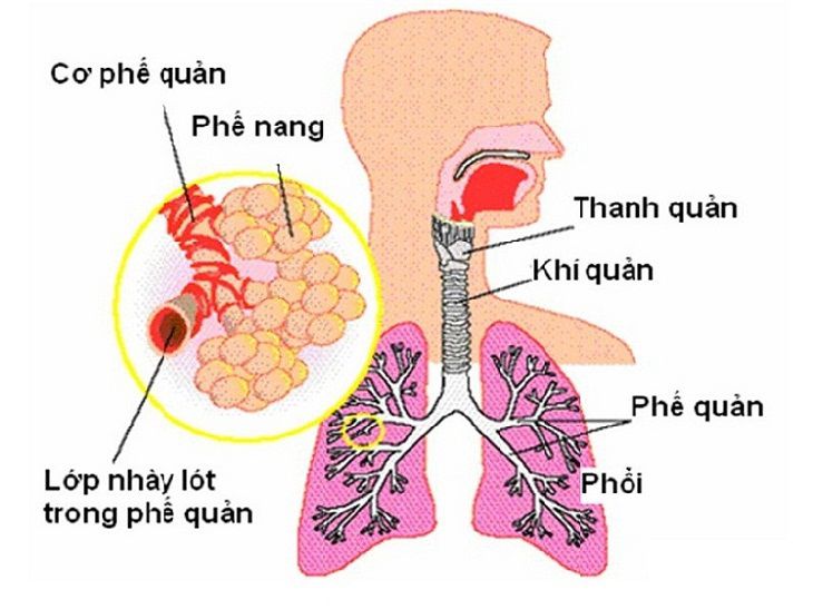 Phương pháp cầu nối chủ phổi này giúp làm giảm khả năng biến dạng phổi