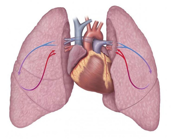 Cầu nối chủ phổi được tiến hành khi người bệnh bị mắc bệnh tứ chứng Fallot