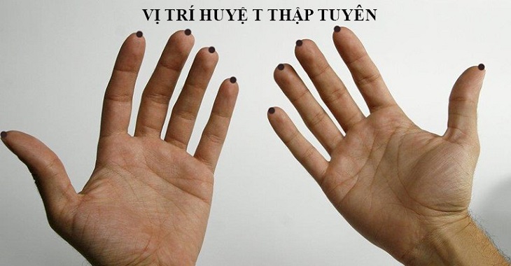 Vị trí huyệt thập tuyên trong cơ thể con người