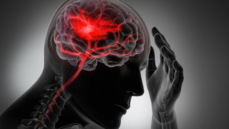 Phù não là hệ quả do bị ứ nước trong nhu mô não kèm nhiều biểu hiện nguy hiểm