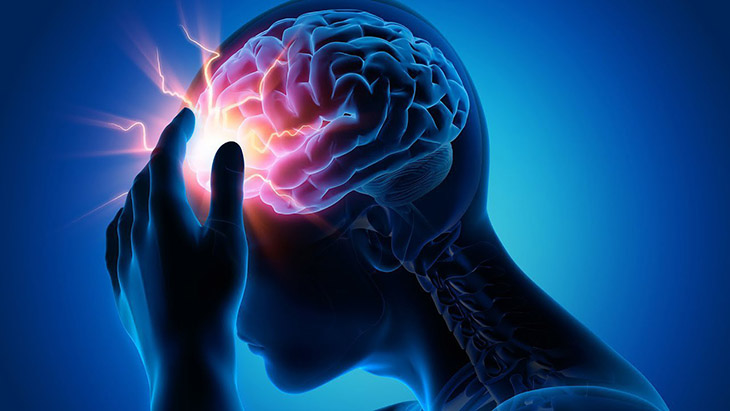 Chảy máu não là một nguyên nhân gây hội chứng tăng áp lực nội sọ