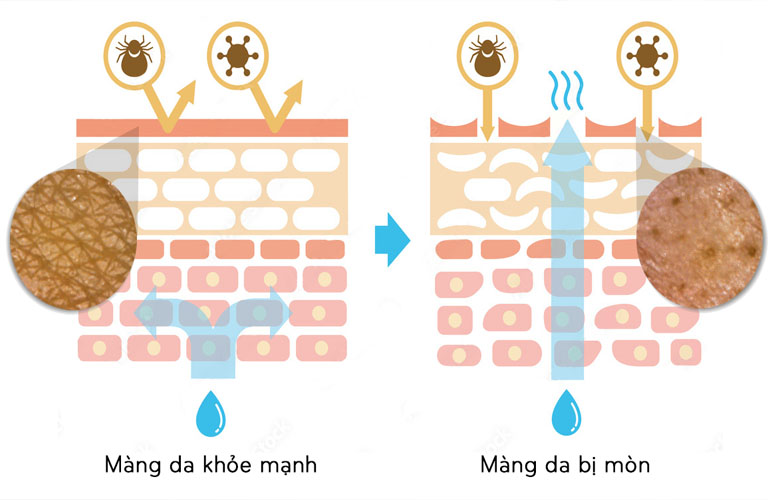 Dùng các sản phẩm có khả năng tái tạo lớp màng Hydrolipidique