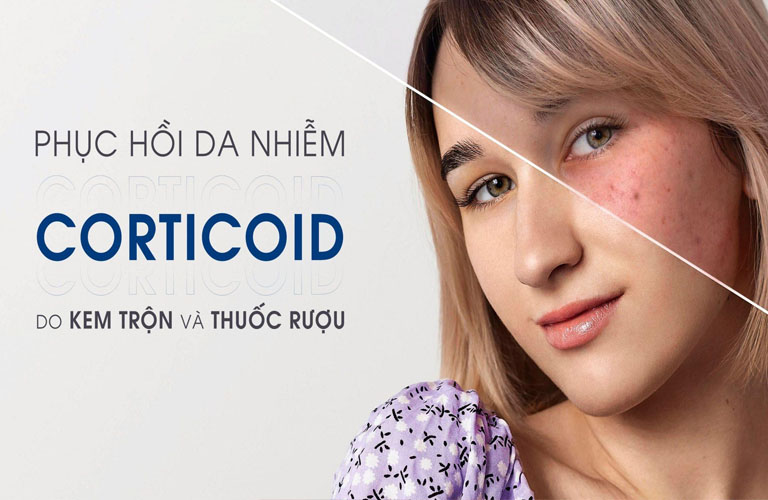 Phục hồi da nhiễm Corticoid là cả một quá trình nên cần kiên trì