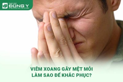 viem-xoang-gay-met-moi