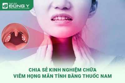 chia-se-kinh-nghiem-chua-viem-hong-man-tinh-bang-thuoc-nam