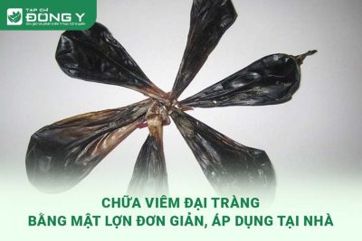 chua-viem-dai-trang-bang-mat-lon