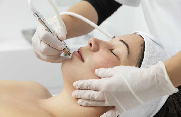Laser giúp kích thích da tăng sinh collagen từ sâu bên trong