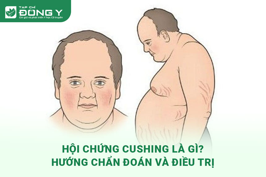 hoi-chung-cushing