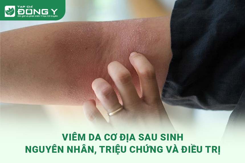 Những Lưu Ý Quan Trọng Cho Mẹ Sau Sinh