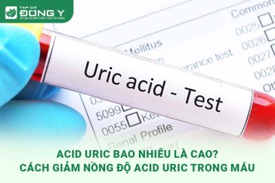 acid-uric-bao-nhieu-la-cao