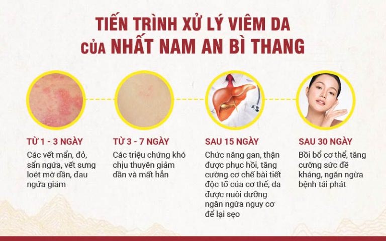 Điều trị viêm da cần thực hiện theo phác đồ chuyên biệt theo từng bước, từng giai đoạn