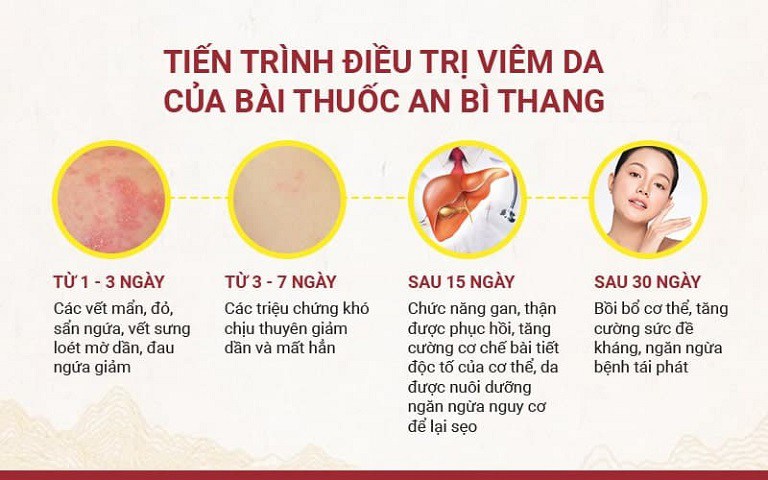 Tiến trình điều trị viêm da của bài thuốc Nhất Nam An Bì Thang