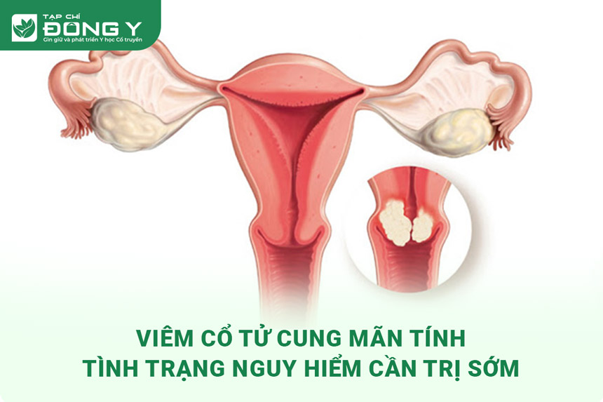 viem co tu cung man tinh