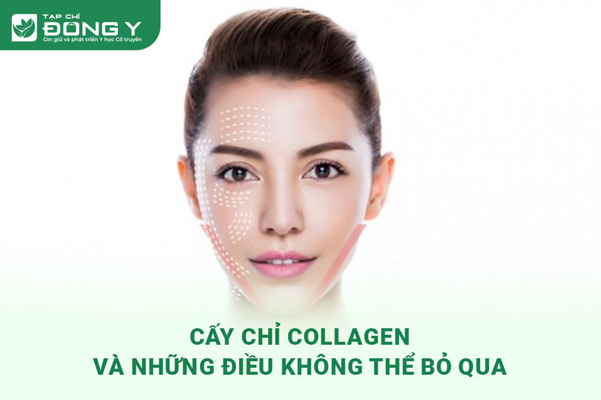 cay-chi-collagen