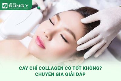 cay-chi-collagen-co-tot-khong