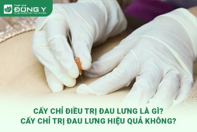 cay-chi-dieu-tri-dau-lung-la-gi-cay-chi-tri-dau-lung-hieu-qua-khong