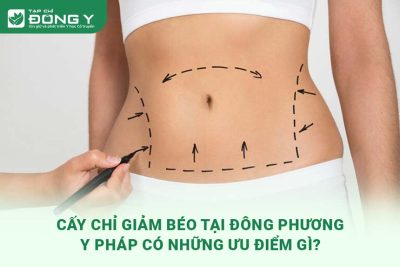 cay-chi-giam-beo-tai-trung-tam-dong-phuong-y-phap-co-nhung-uu-diem-gi