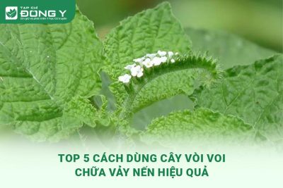 cay-voi-voi-chua-vay-nen