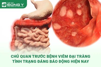 chu-quan-truoc-benh-viem-dai-trang-tinh-trang-bao-dong