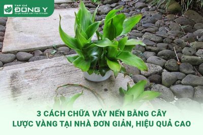 chua-vay-nen-bang-cay-luoc-vang