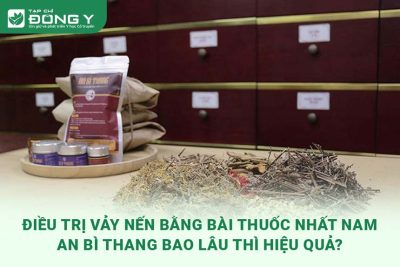 dieu-tri-vay-nen-bang-bai-thuoc-nhat-nam-an-bi-thang-bao-lau-thi-hieu-qua