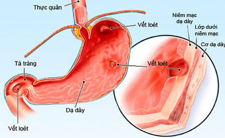 4. Các Tình Huống Khẩn Cấp