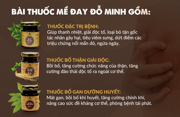 Liệu trình "3 trong 1" bài thuốc Mề đay Đỗ Minh