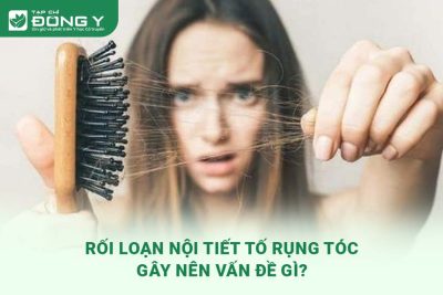 roi-loan-noi-tiet-to-rung-toc