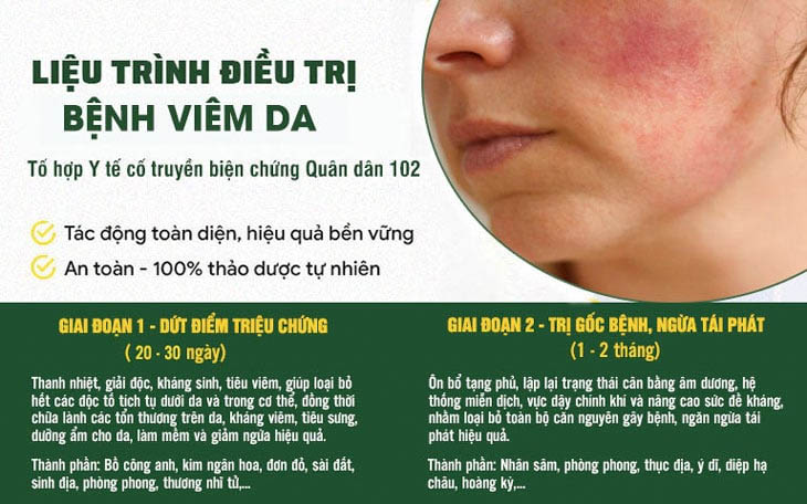 Phác đồ điều trị viêm da theo 2 giai đoạn tại Quân Dân 102