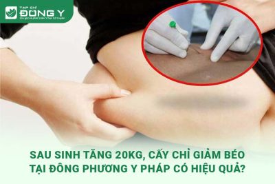 sau-sinh-tang-20kg-cay-chi-giam-beo-tai-trung-tam-ung-dung-dong-phuong-y-phap