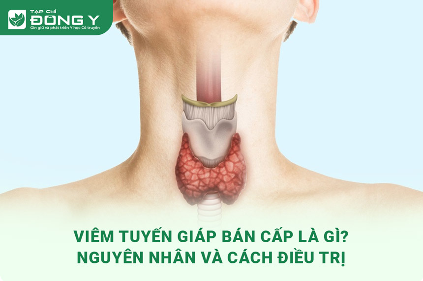 viem tuyen giap ban cap