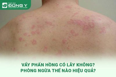 vay-phan-hong-co-lay-khong