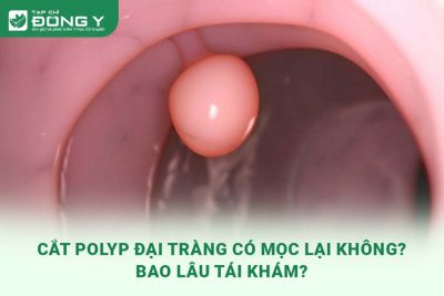 cat-polyp-dai-trang-co-moc-lai-khong