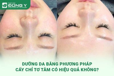 duong-da-bang-phuong-phap-cay-chi-to-tam-co-hieu-qua-khong