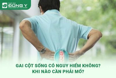 gai-cot-song-co-nguy-hiem-khong