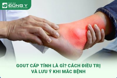 gout-cap-tinh