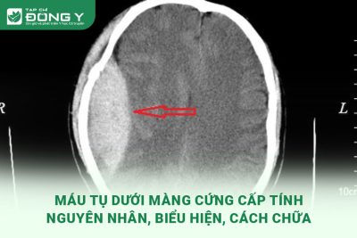 mau-tu-duoi-mang-cung-cap-tinh