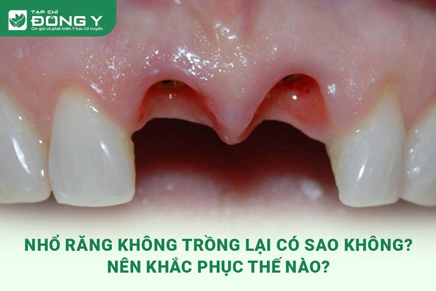 nho-rang-khong-trong-lai-co-sao-khong