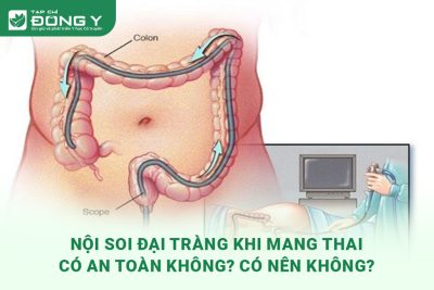 noi-soi-dai-trang-khi-mang-thai